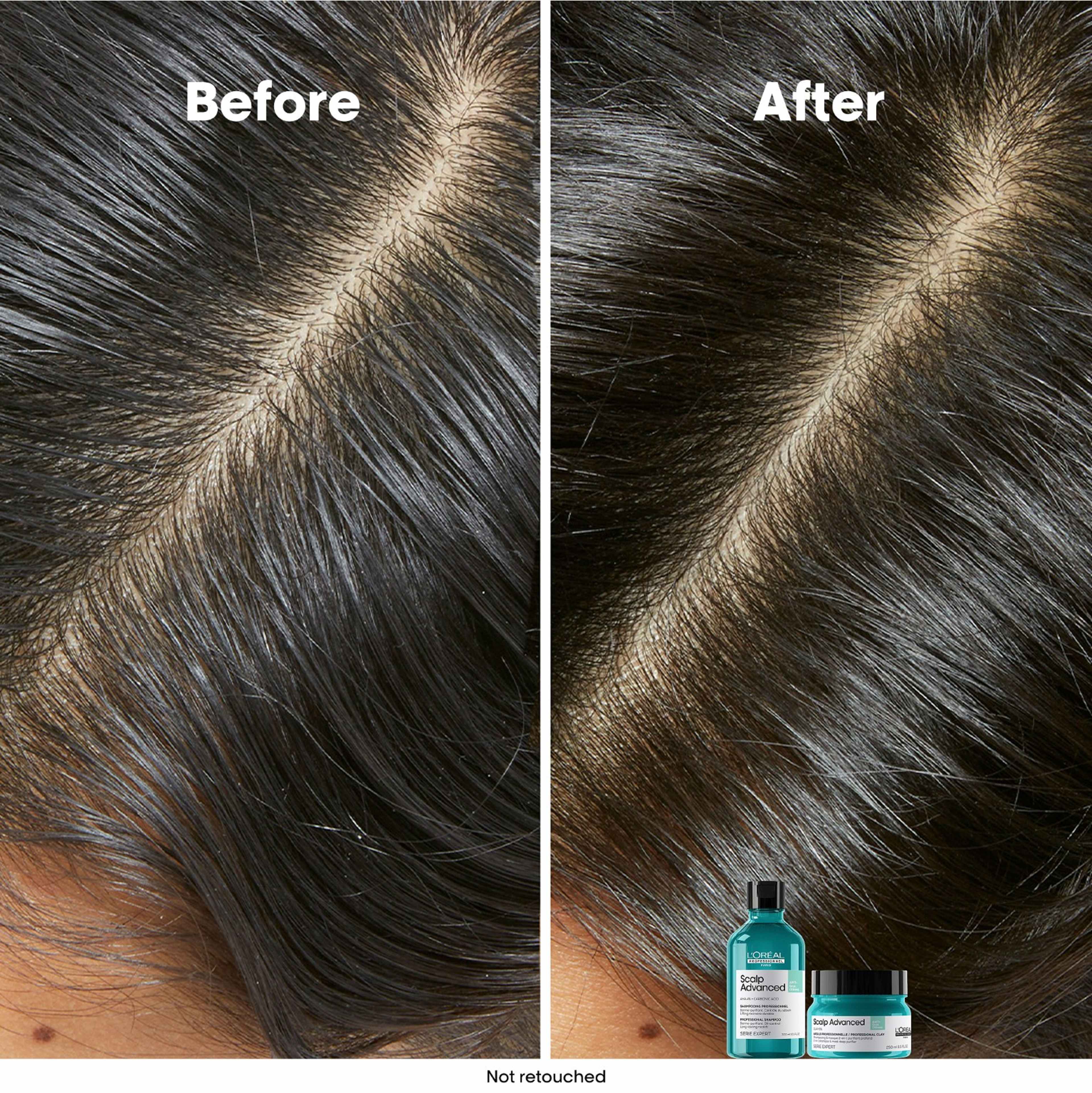 Scalp Advanced Anti-Oiliness Shampoo, från L’Oréal Professionnel. Klicka för att öppna bilden i stort format