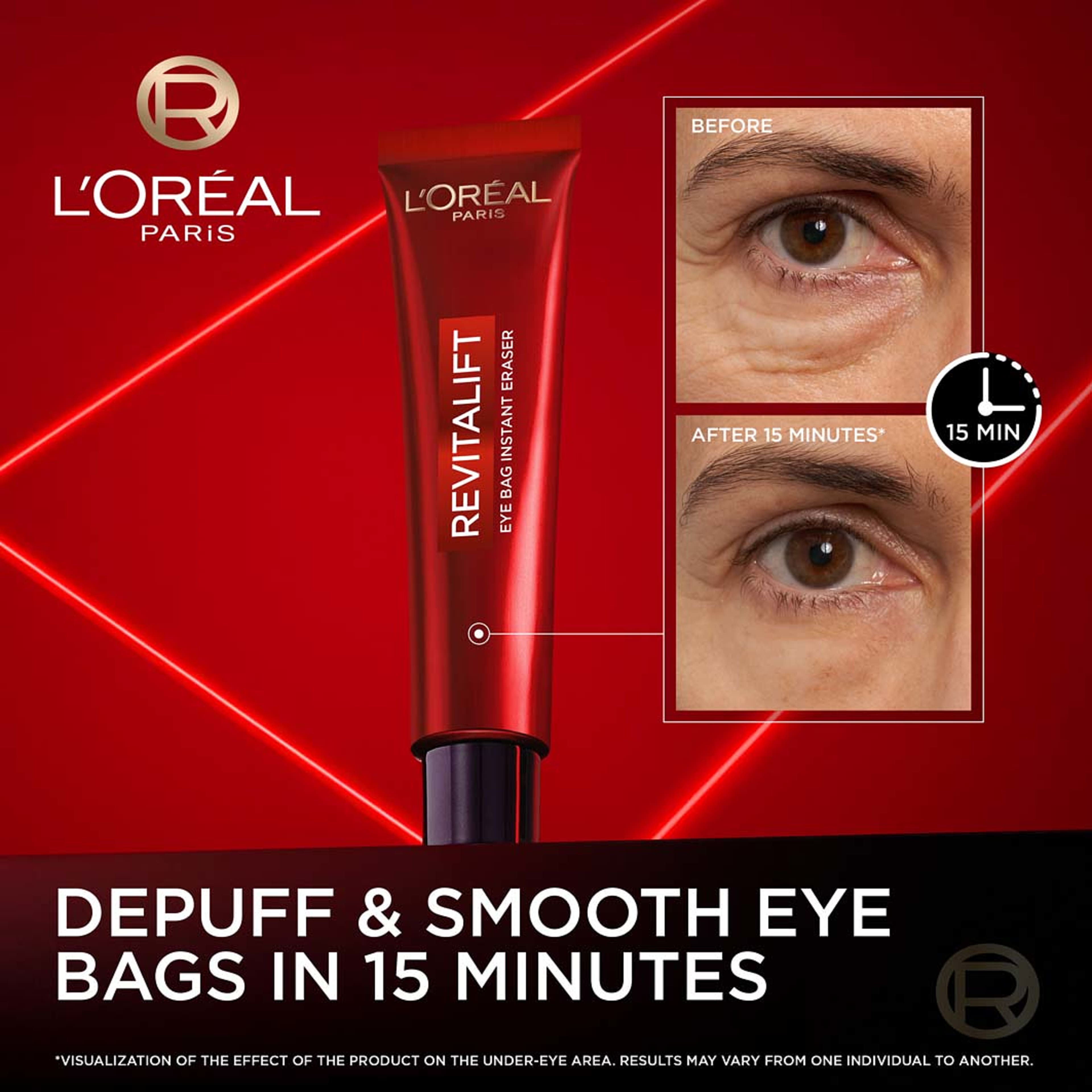 Revitalift Laser Eye Bag Instant Eraser, från L'Oréal Paris. Klicka för att öppna bilden i stort format