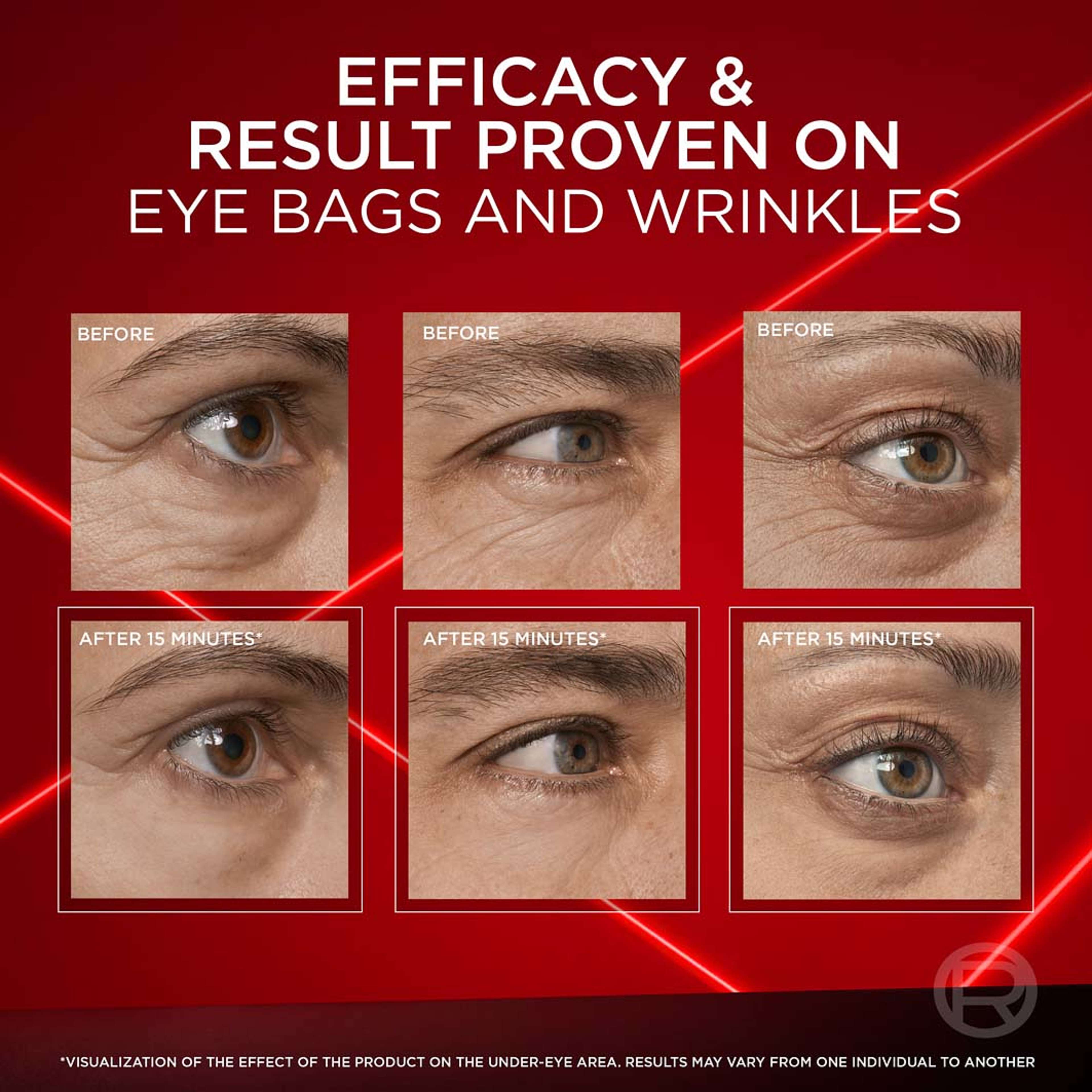 Revitalift Laser Eye Bag Instant Eraser, från L'Oréal Paris. Klicka för att öppna bilden i stort format