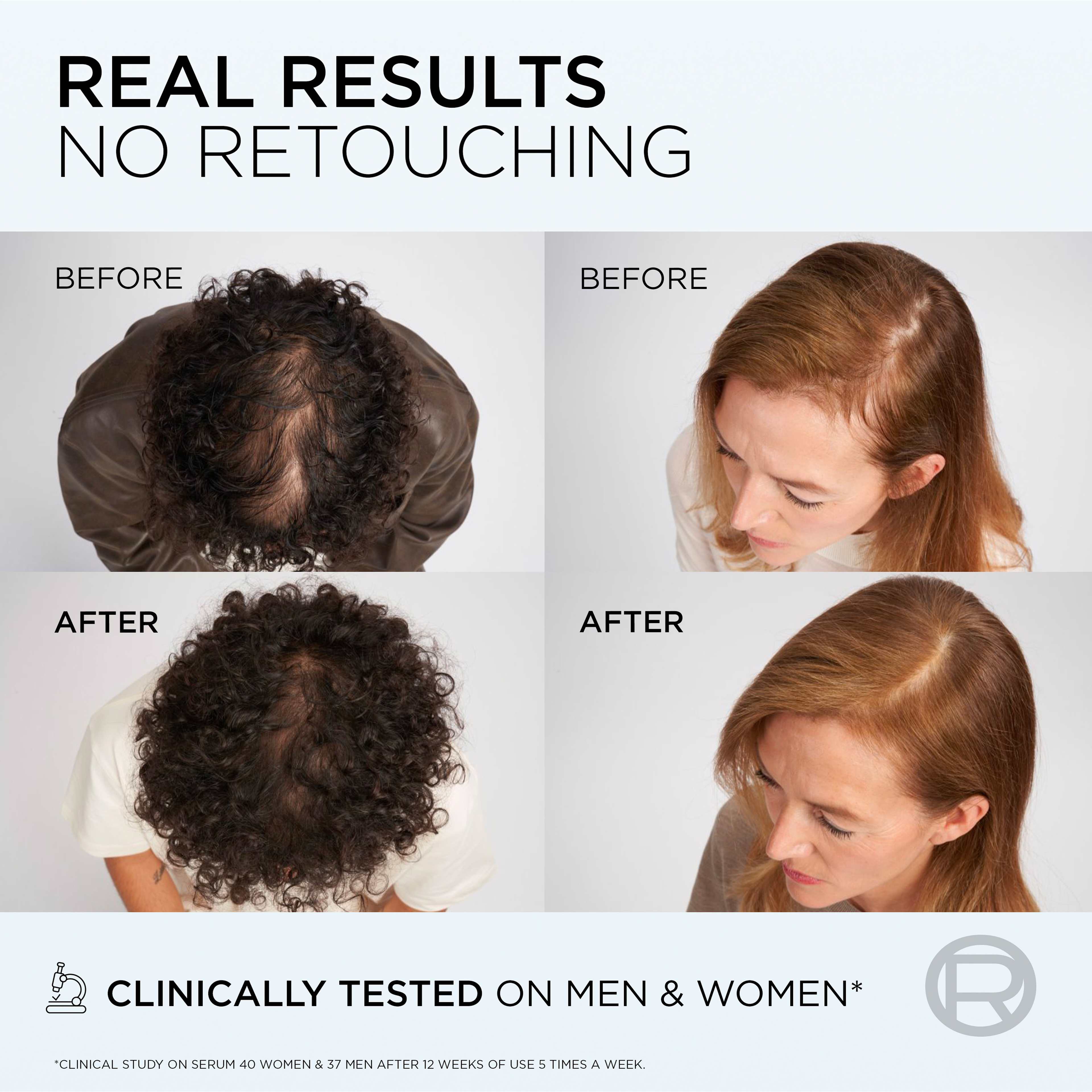 Elvital Growth Booster Shampoo