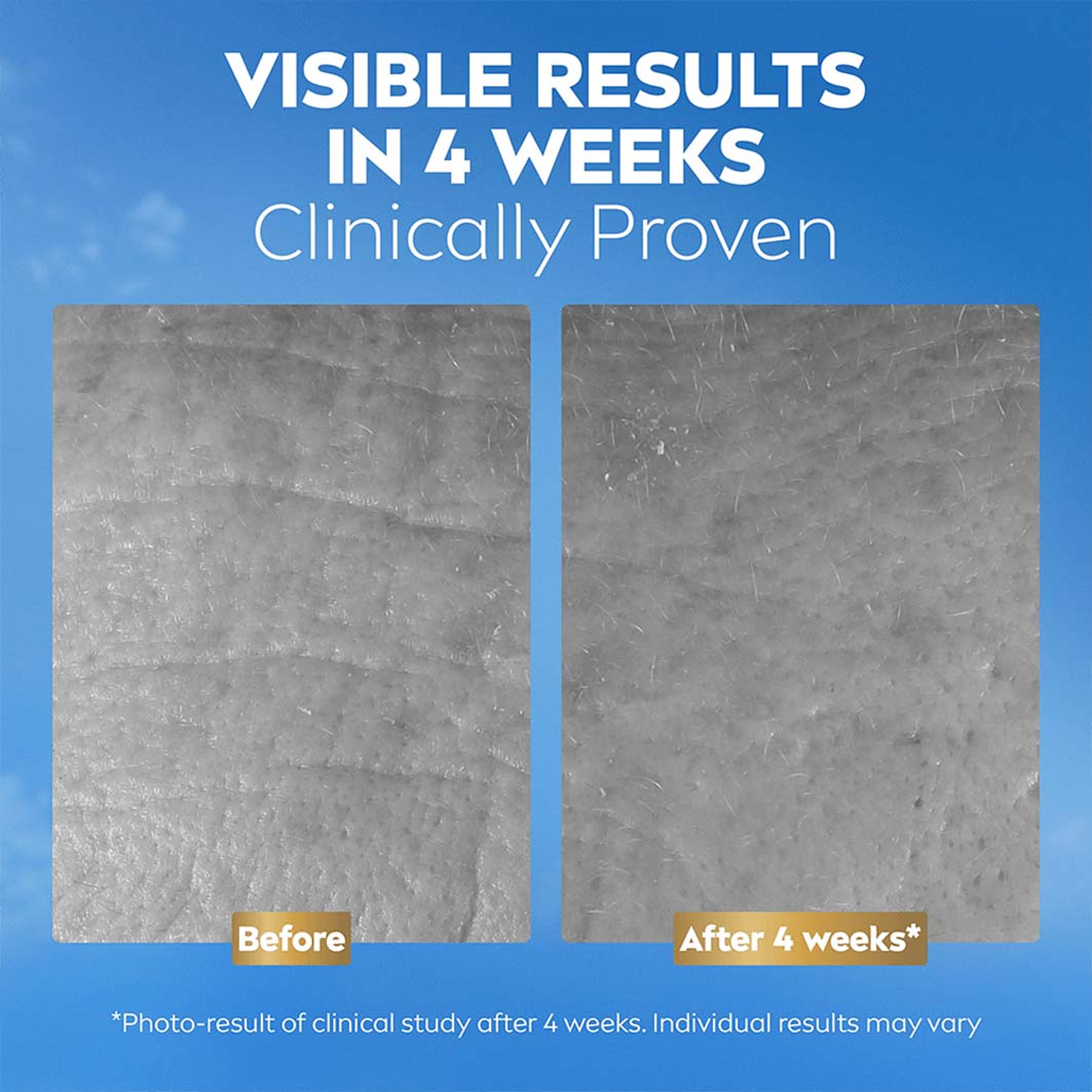 Ansiktskräm Q10 Anti-Wrinkle Collagen Expert Day & Night Facial Butter, från NIVEA. Klicka för att öppna bilden i stort format