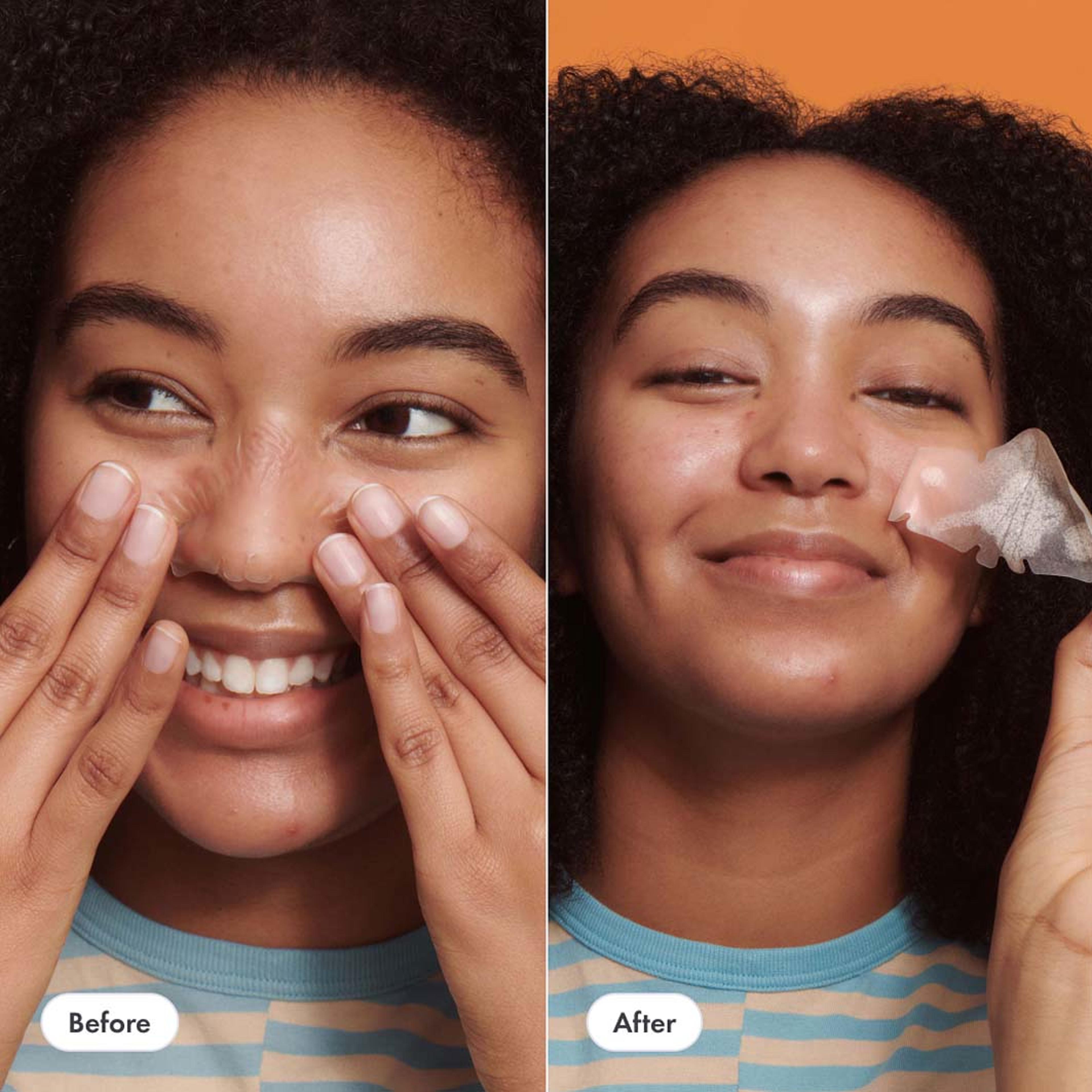 Nose Patch, från HERO. Klicka för att öppna bilden i stort format