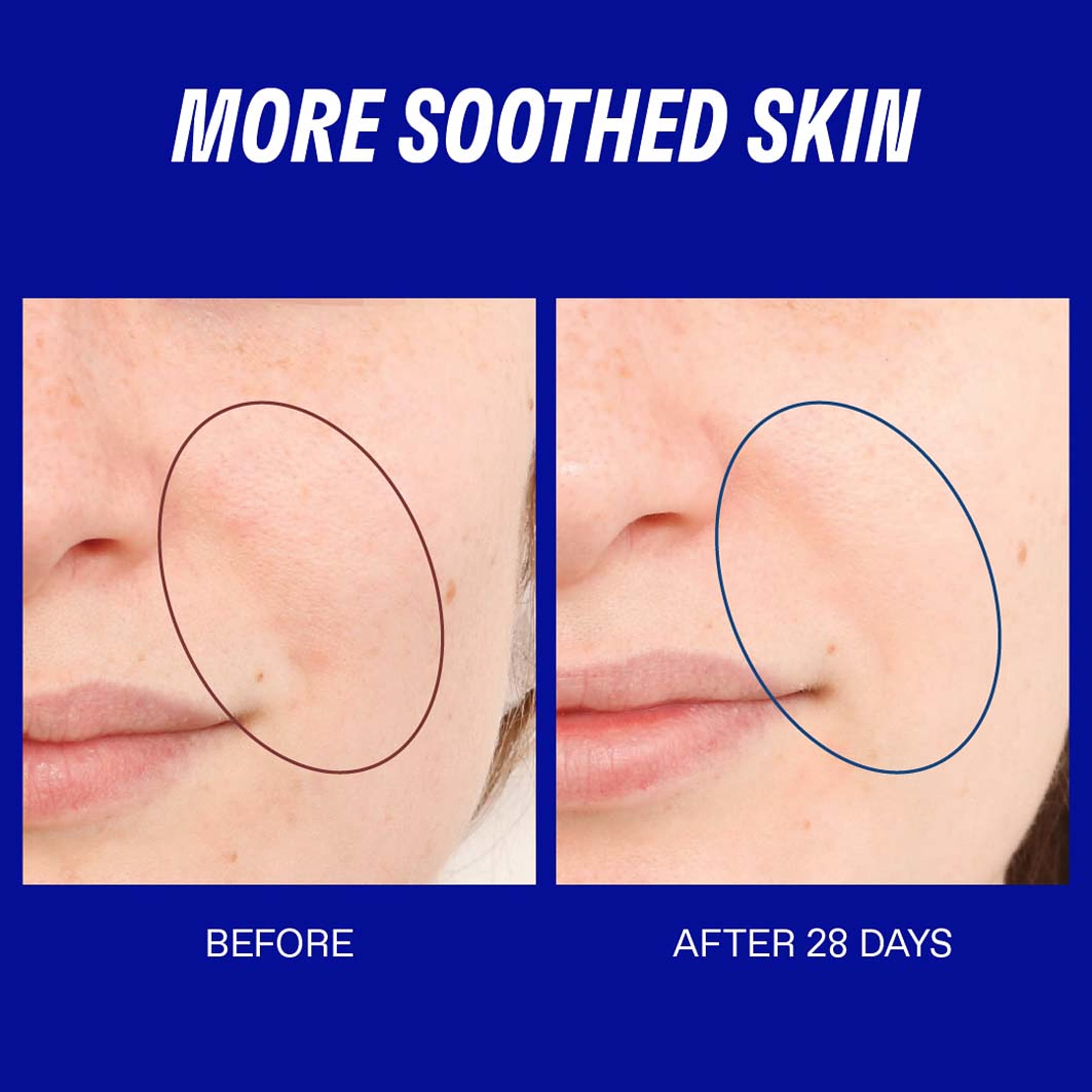 Smart Yoghurt™ Probiotic Super Serum, från Korres. Klicka för att öppna bilden i stort format