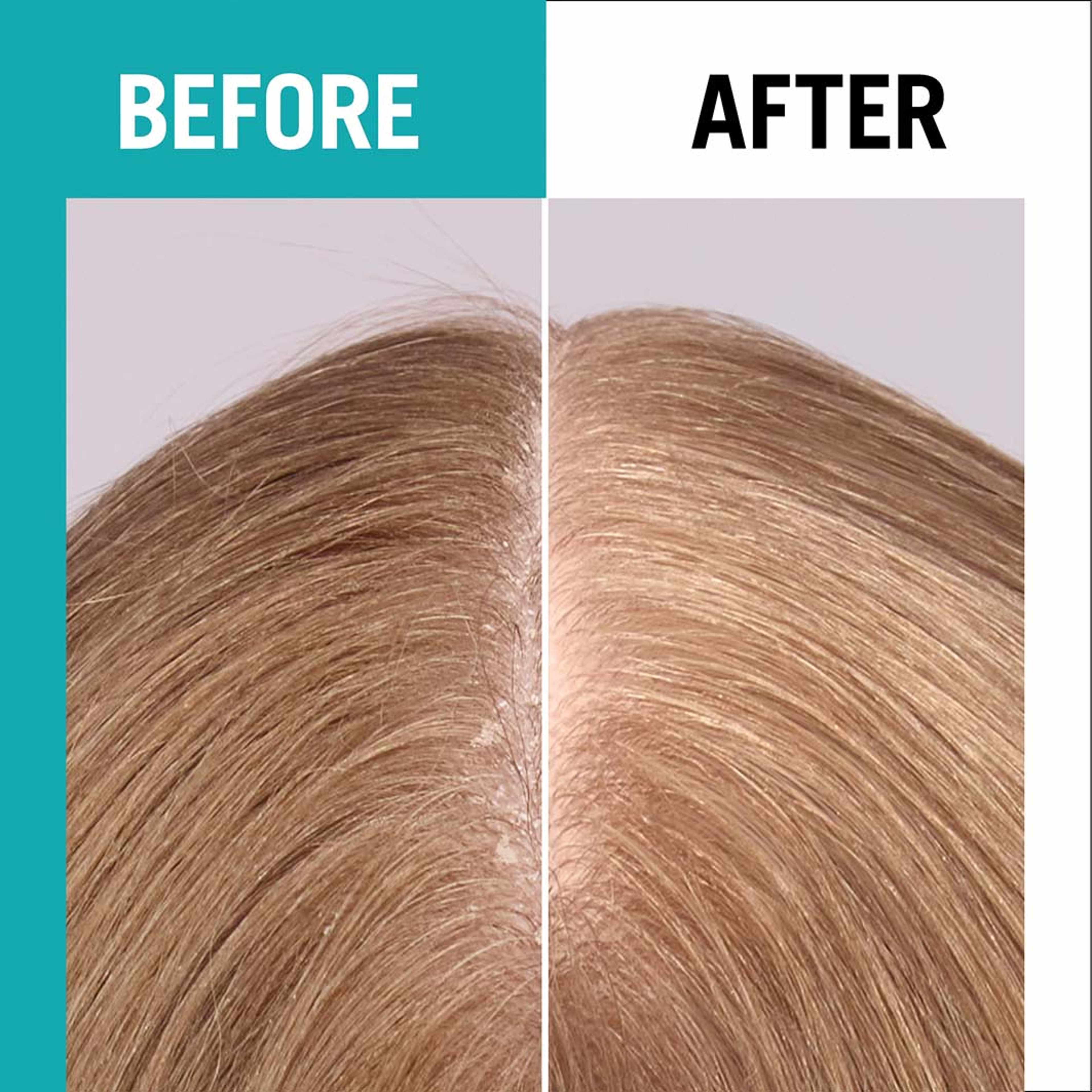 Gliss Scalp Balance Scalp Spray, från Schwarzkopf. Klicka för att öppna bilden i stort format