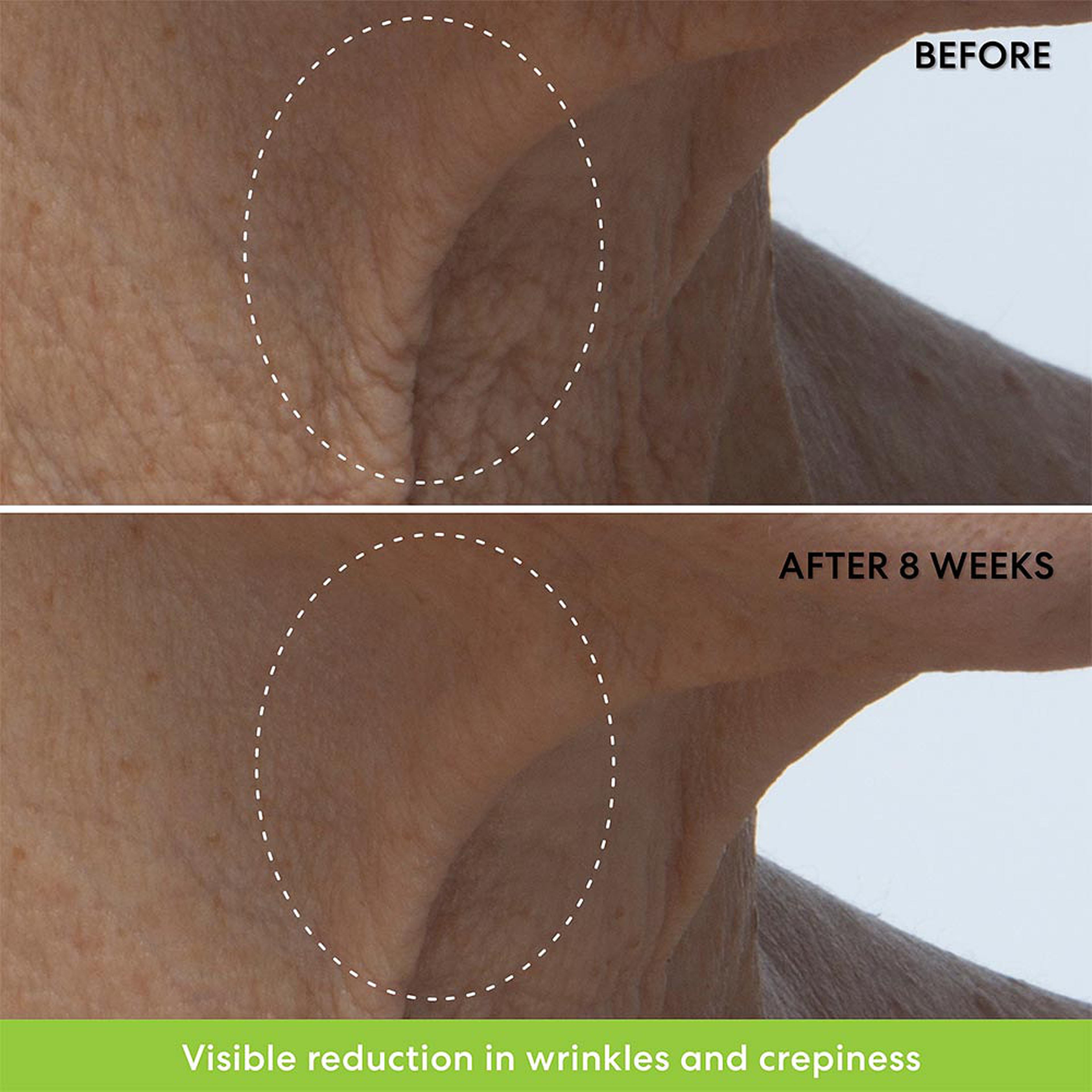 Ageless Phyto-Retinol Neck Cream