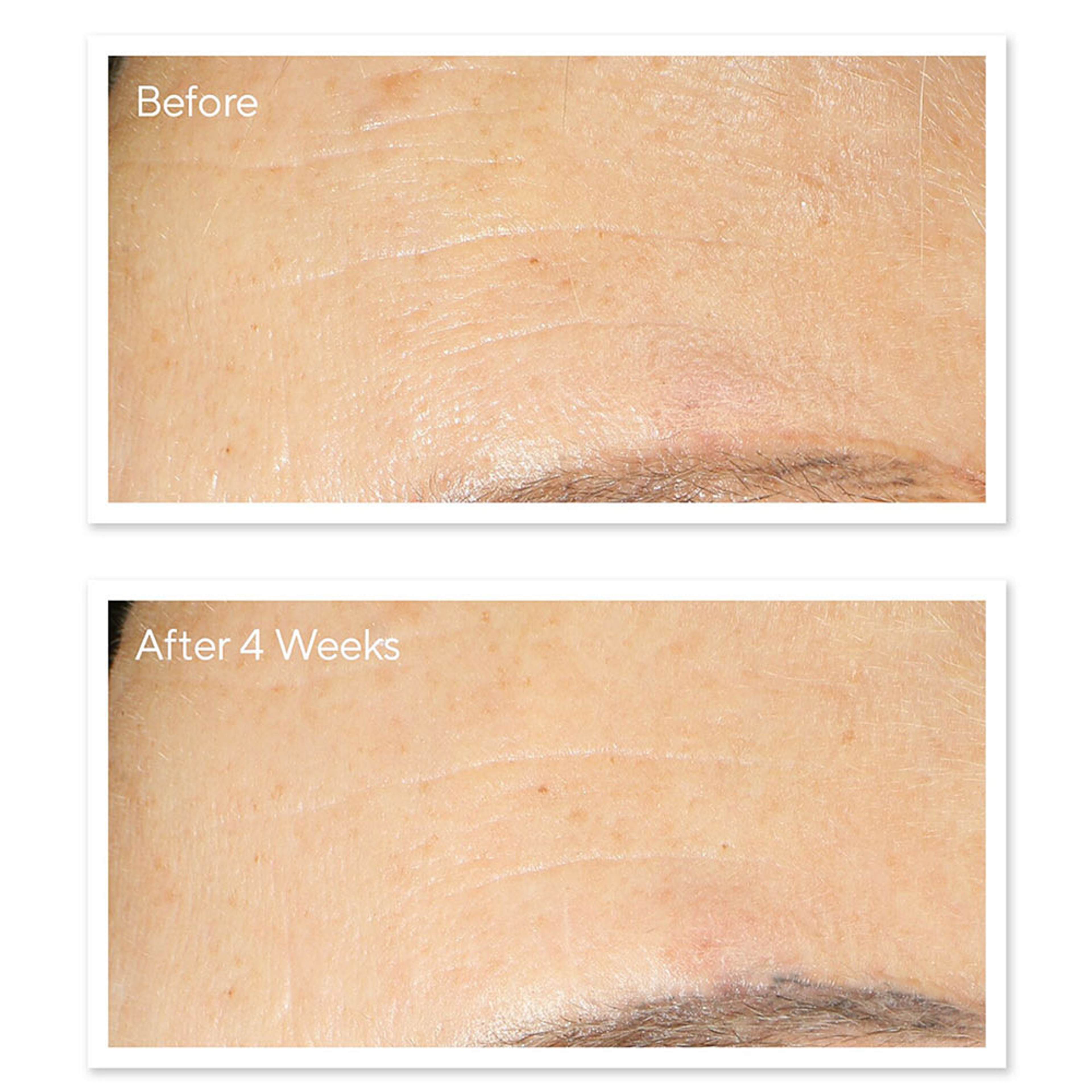 Retinol Youth Renewal Night Cream