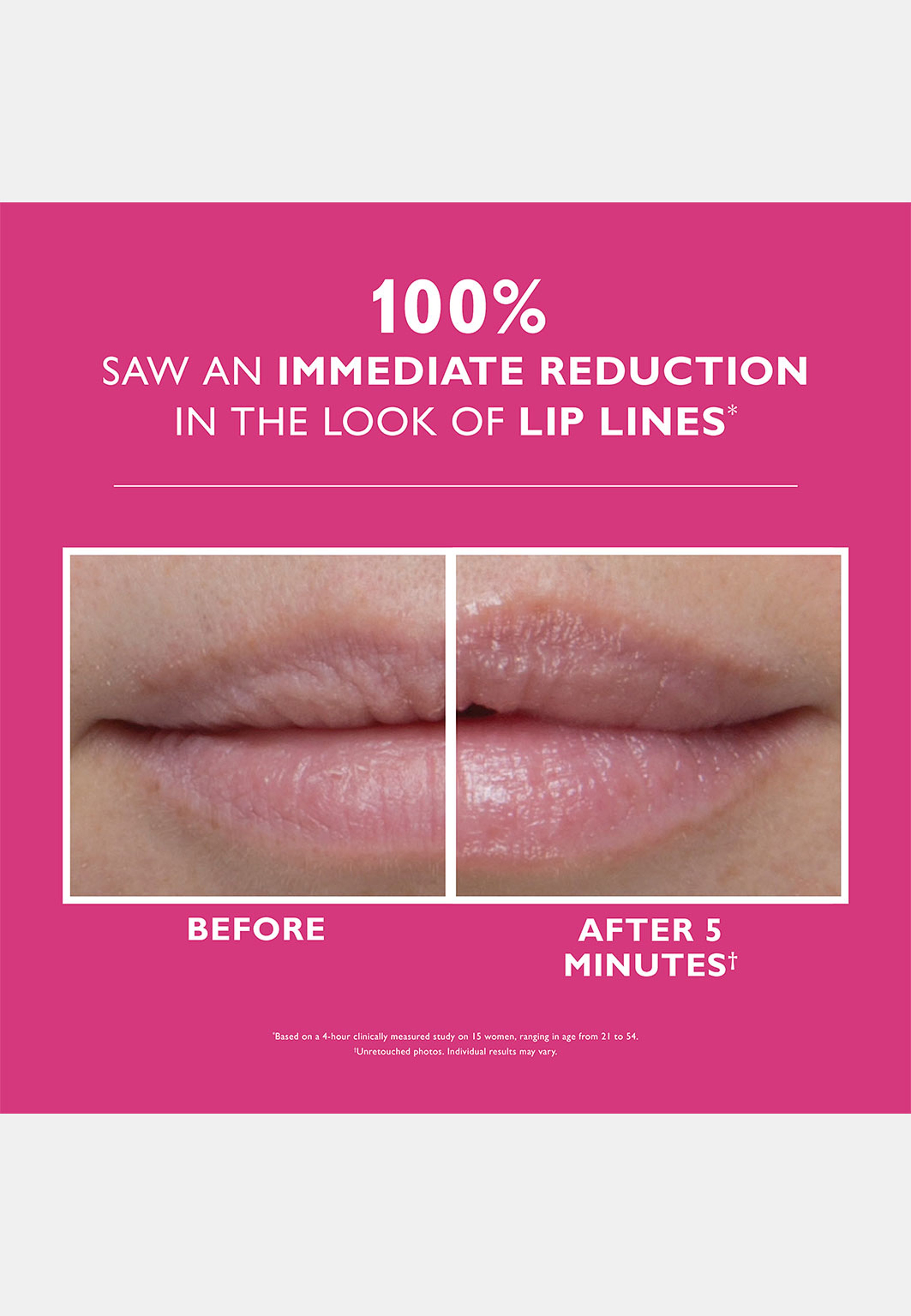 Instant FIRMx® Lip Filler