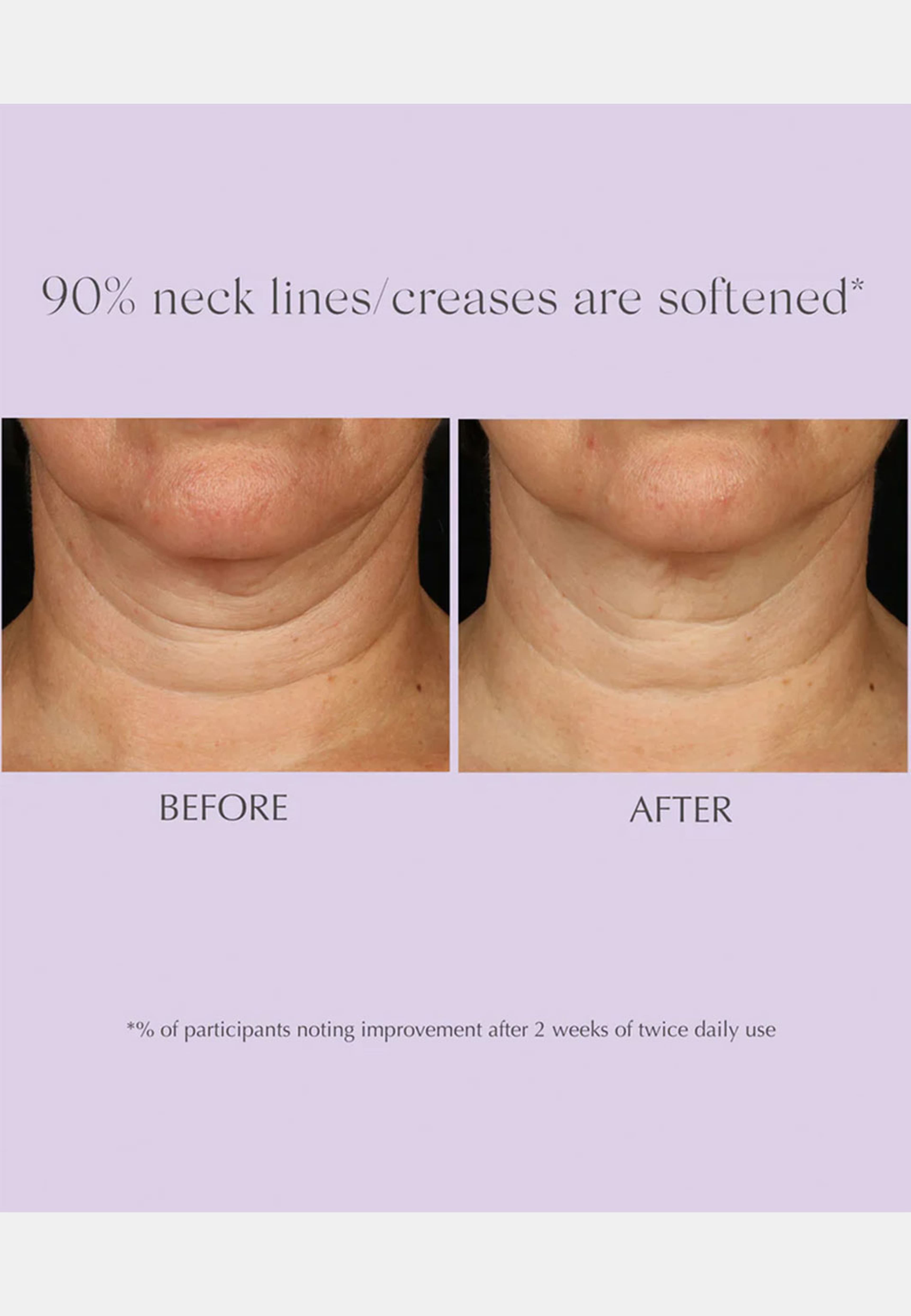 Age Reverse Toning Neck Cream