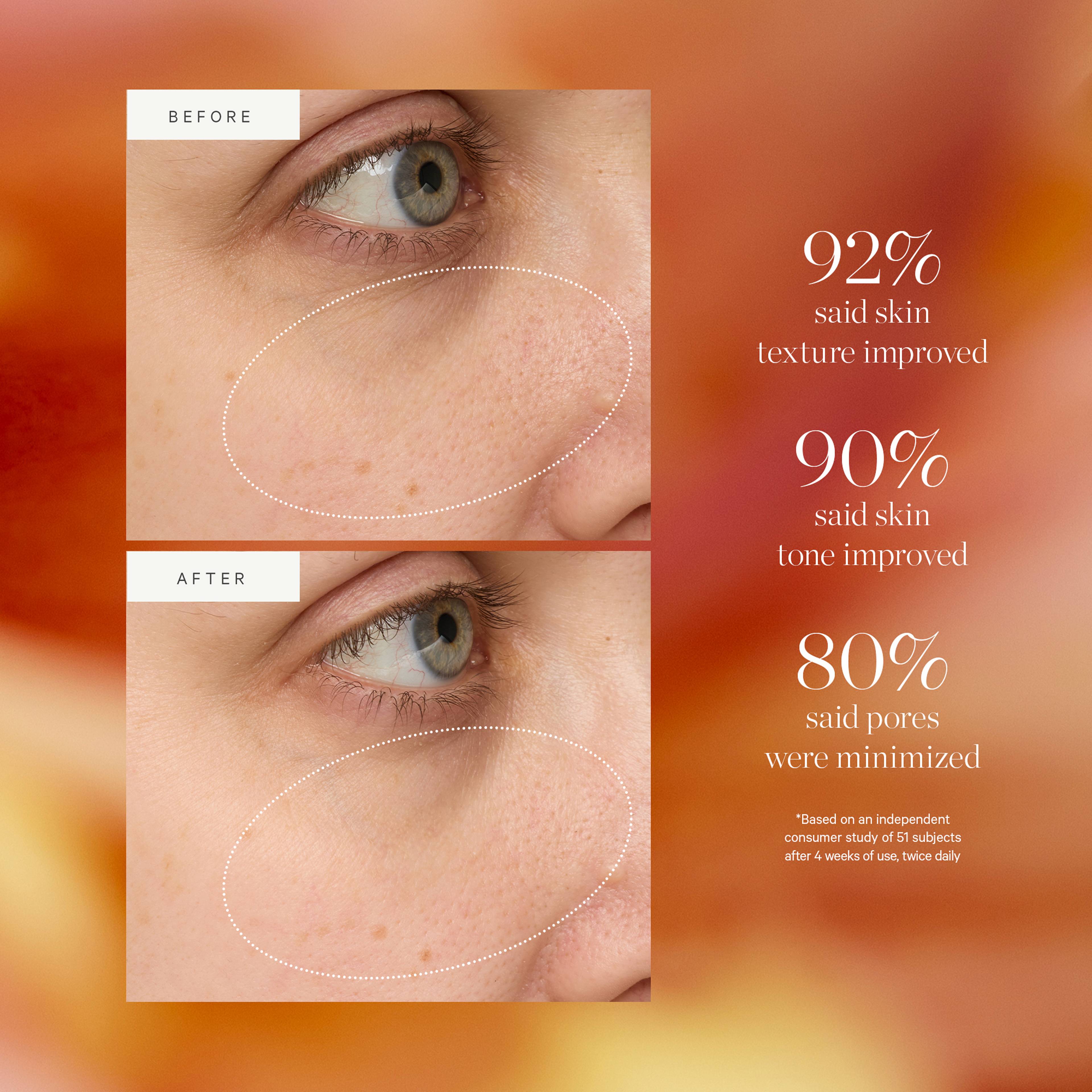 Turmeric Glow Drops Niacinamide Alternative Serum, från KORA Organics.