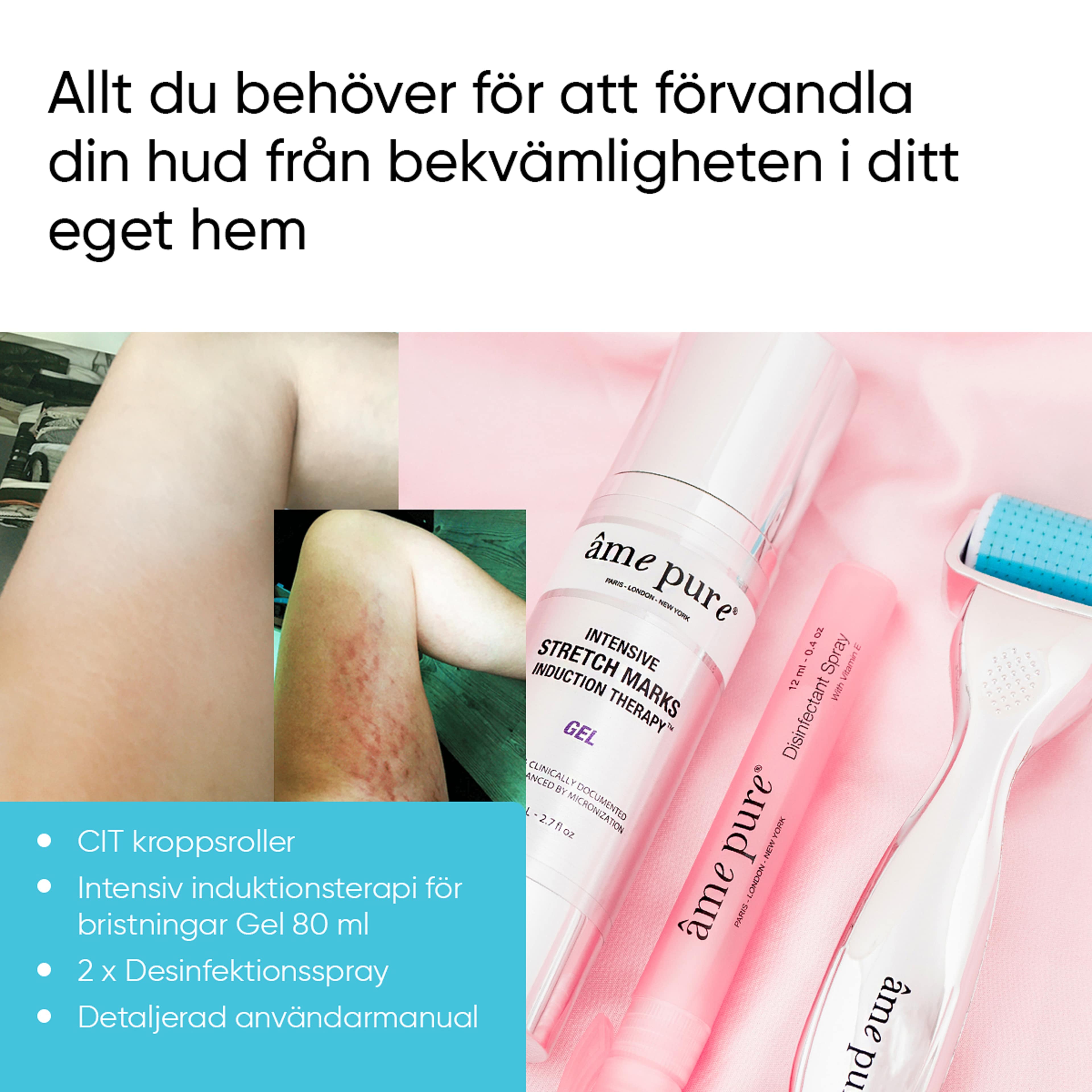 Âme Pure® Body Basic Stretch Marks Kit