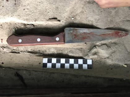 Житель Калужской области порезал обидчика за пощечину