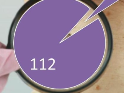 Калужане проверяют подозрительные родинки у онкологов при помощи онлайн-сервиса