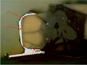 EOS engulfed electrodes