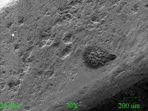 Micrograph of pitting on fourth spring