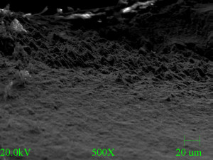 Micrograph of third spring, failure