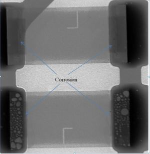 Radiograph of corrosion on R1 and R2