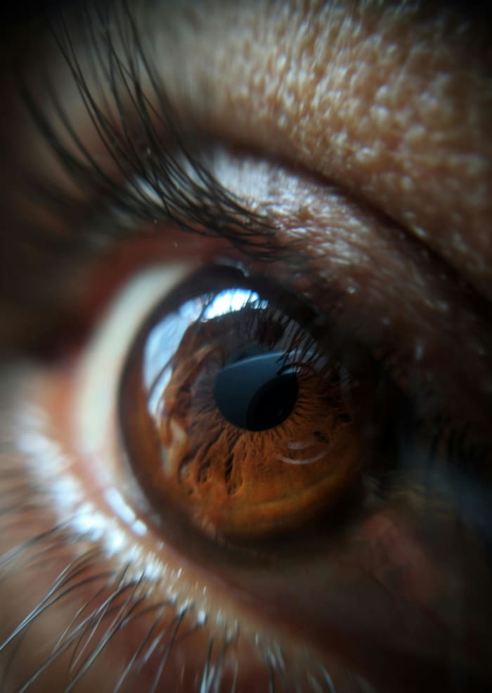 Assisted Vision