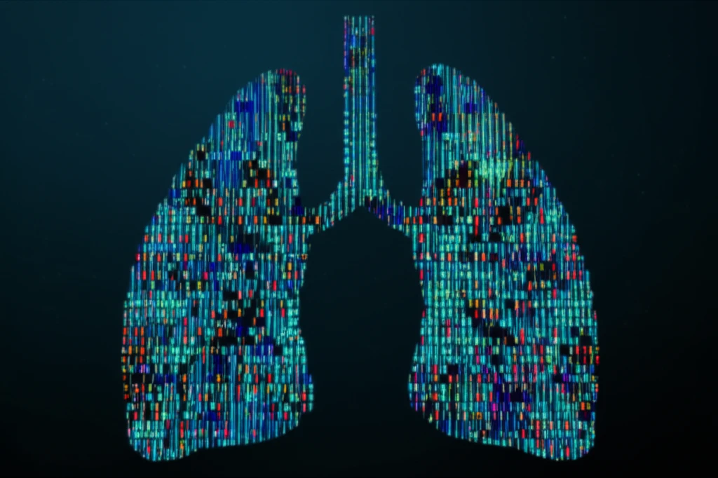NGS revolutionizing pneumonia diagnosis
