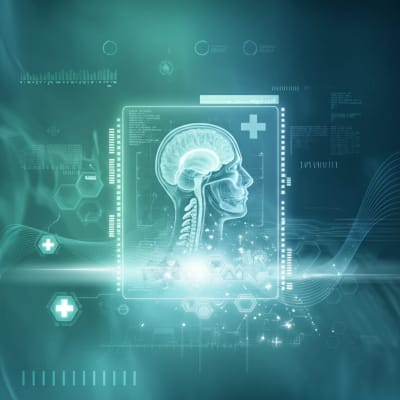Medical scan transitioning from noisy to clear