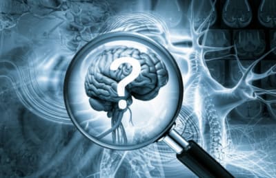 Surreal illustration of a brain with optic nerves and spinal cord, partially obscured by a distorted lens.