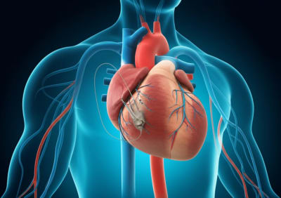 Illustration of a heart with a biventricular pacemaker, symbolizing improved cardiac function and CRT's impact.
