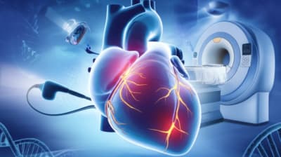 Heart with glowing areas representing inflammation
