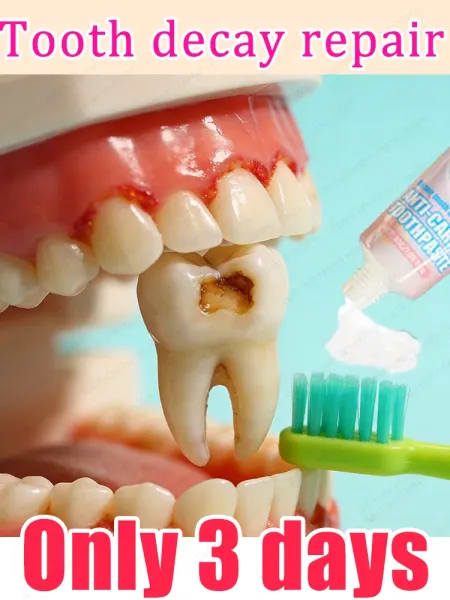 Cepille los dientes dos veces al día, por la mañana y por la noche. Los dientes se pueden reparar fácilmente en tres días.