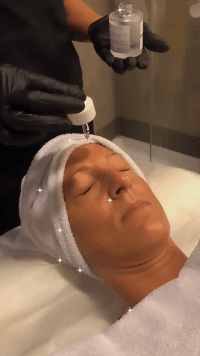 AcidoIaluronico_PostSole.gif