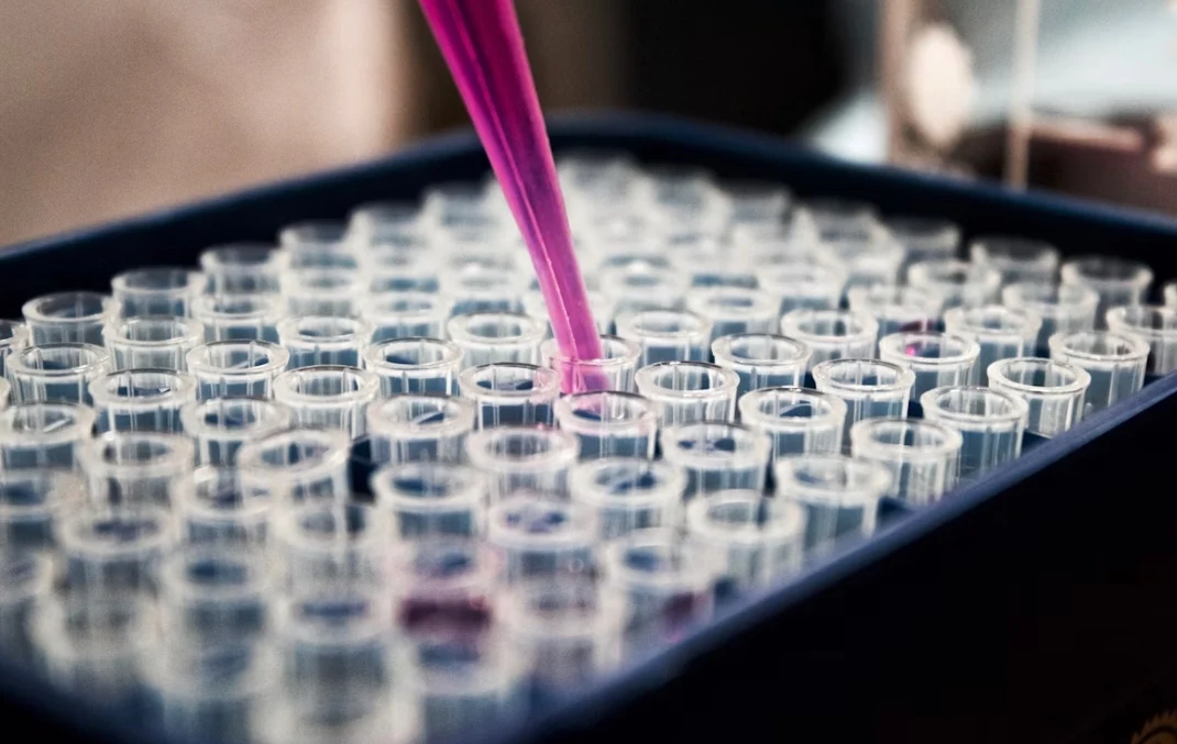 Jerez: CCOO denuncia falta de personal en Microbiología del Hospital