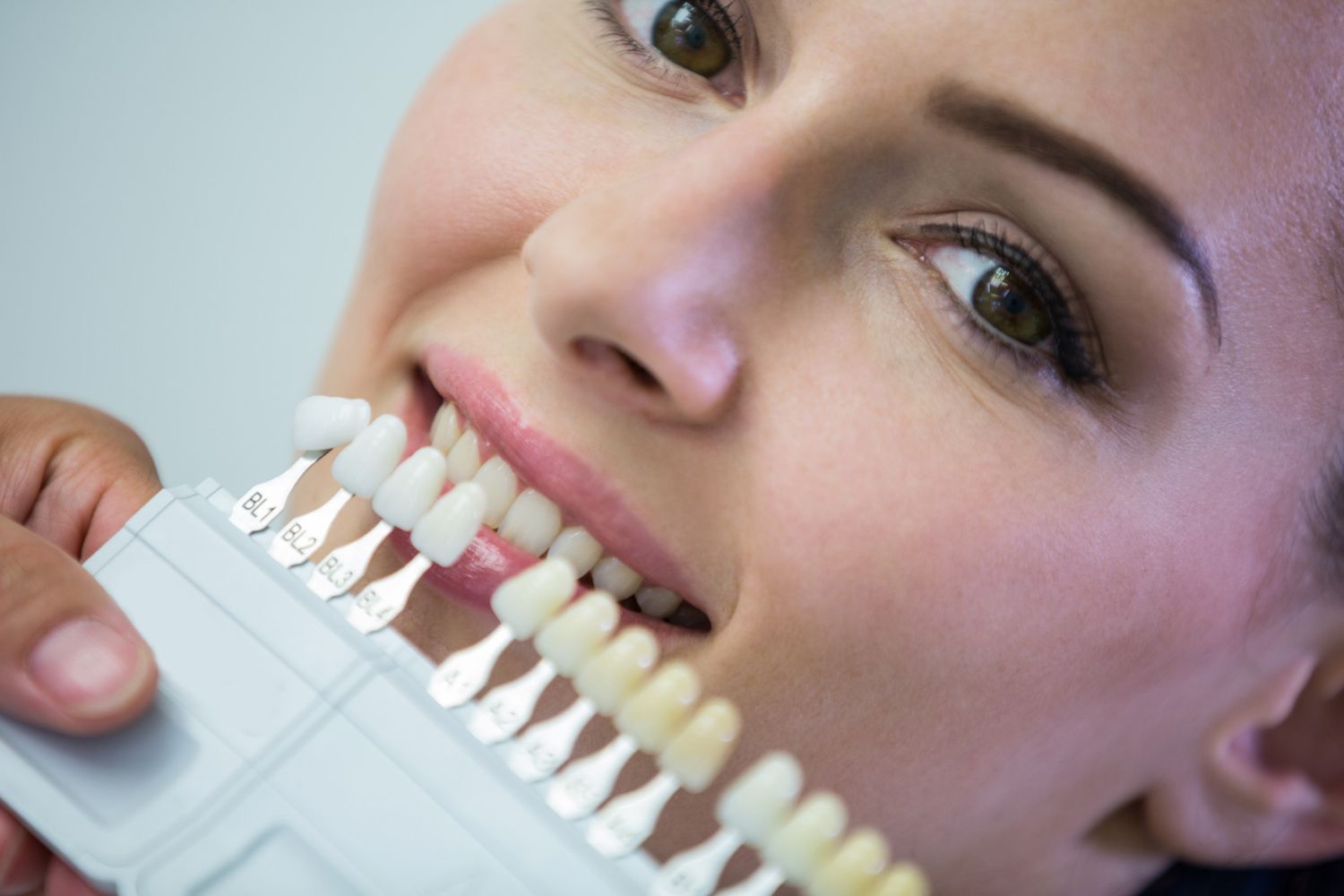 https://res.cloudinary.com/dmwww3mzd/image/upload/v1665413230/facetas_dentarias_1_0f0e1ce0e5.jpg