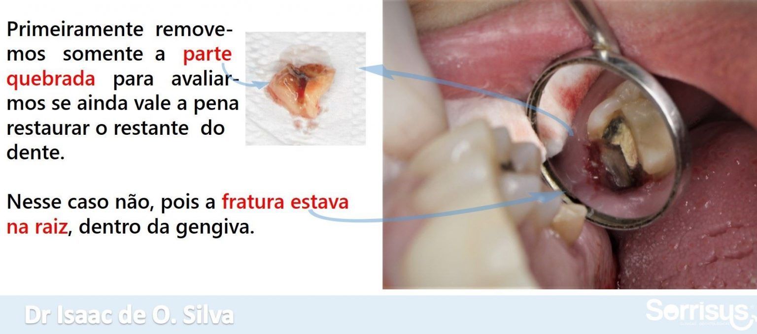 https://res.cloudinary.com/dmwww3mzd/image/upload/v1660661011/4_2_175e0caec1.jpg