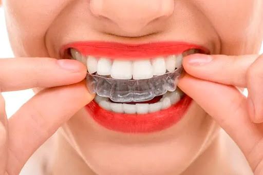 https://res.cloudinary.com/dmwww3mzd/image/upload/v1665412564/como_funciona_o_clareamento_dental_2_aeb4666c76.jpg