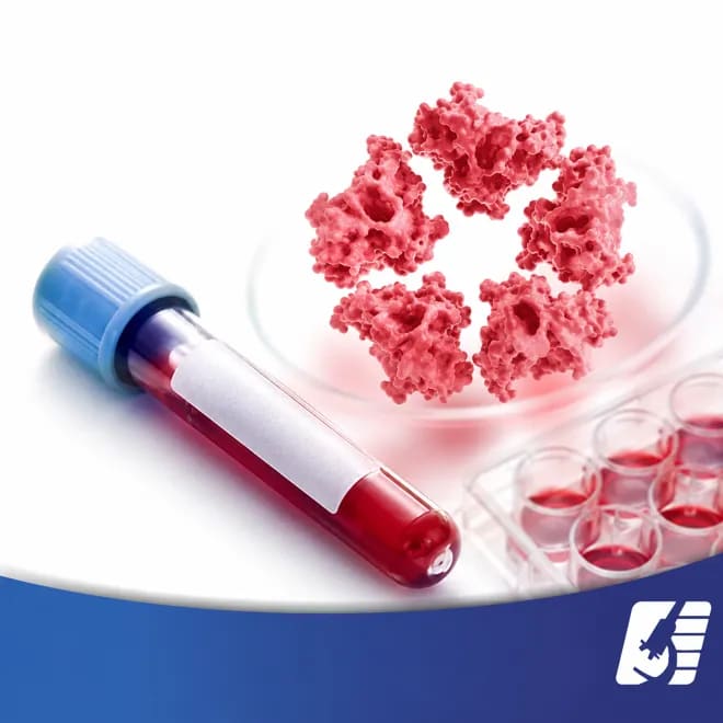 proteina-C-reactiva-(PCR)