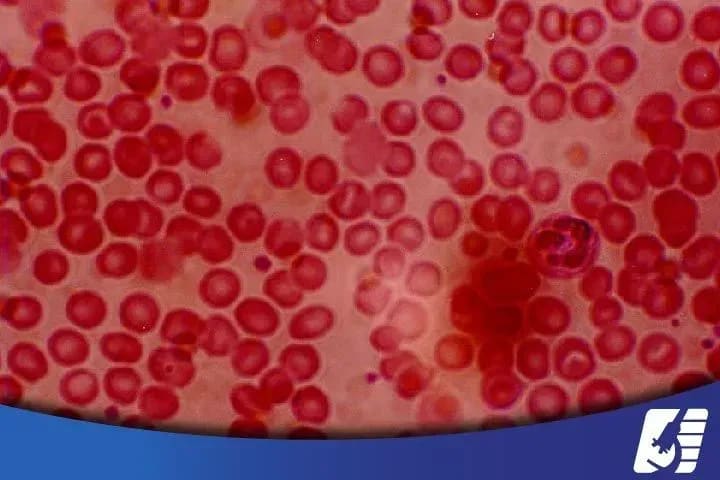 biometria-hematica