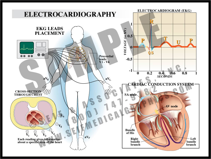 Electrocardiography - S&A Medical Graphics