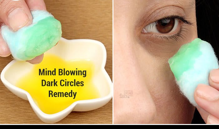 Home Remedies for Dark Circles under the Eyes | Top 10 Home Remedies