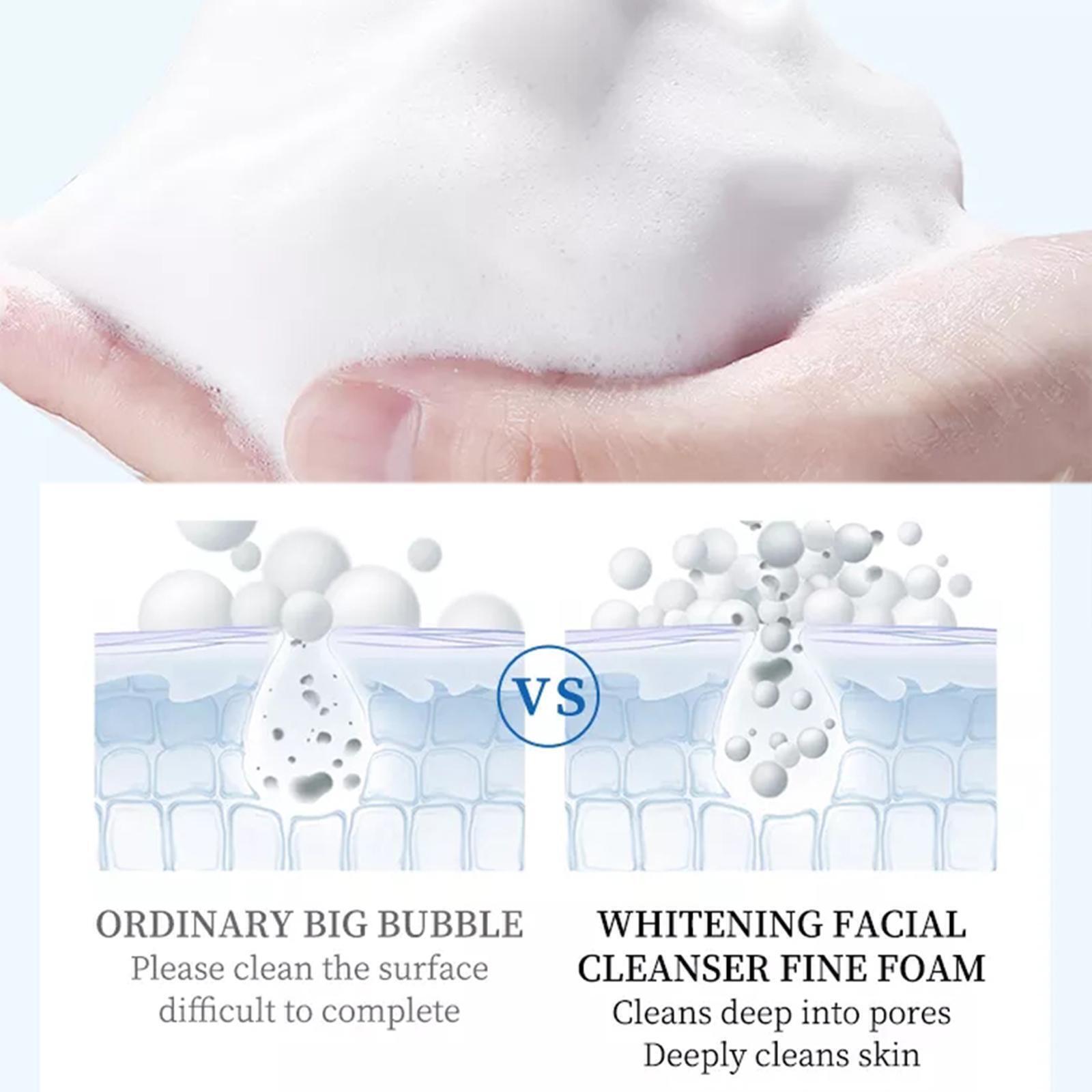 Freckle Remover For Skin Whitening - عرض التفاصيل 3