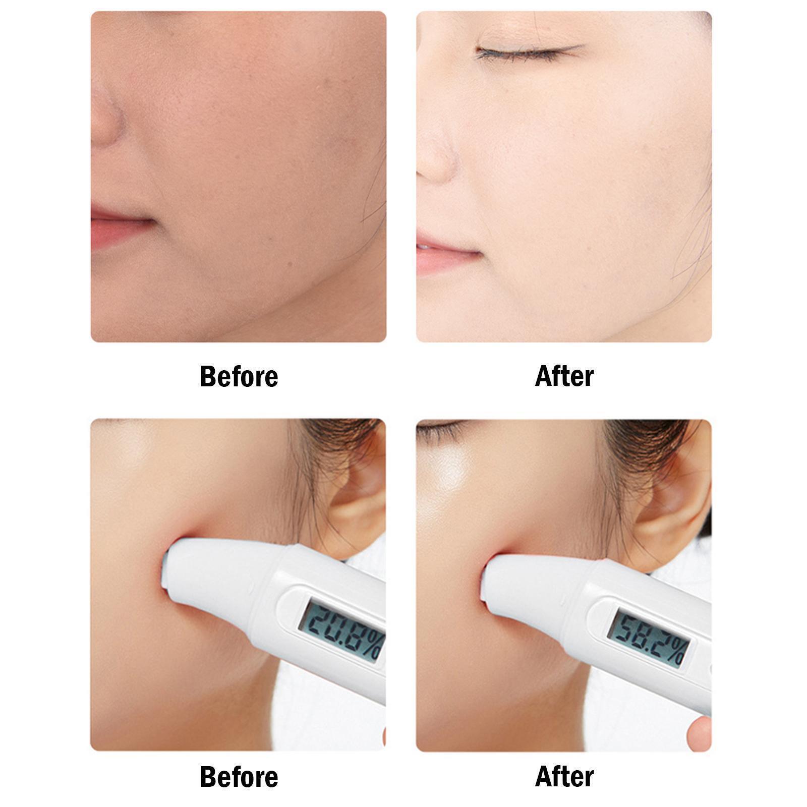 Freckle Remover For Skin Whitening - عرض التفاصيل 13