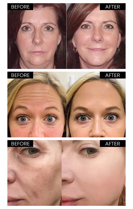 Collagen Face Serum Set - عرض التفاصيل 15