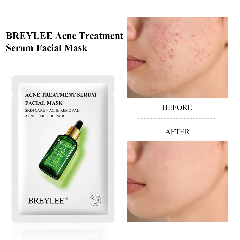 Acne Treatment Serum