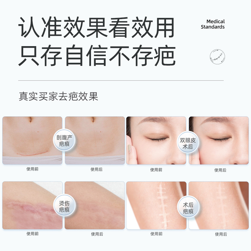 Silicone Patch For Wrinkles Removing - عرض التفاصيل 12
