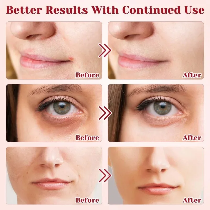 Retinol Dragon's Blood Cream