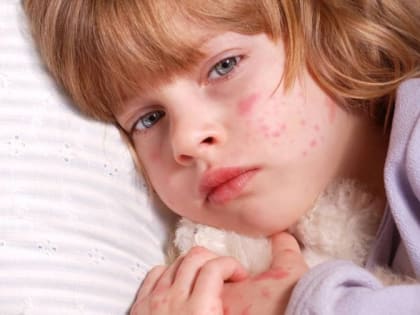 Отсутствие прививок от кори  подвергают опасности здоровье  детей