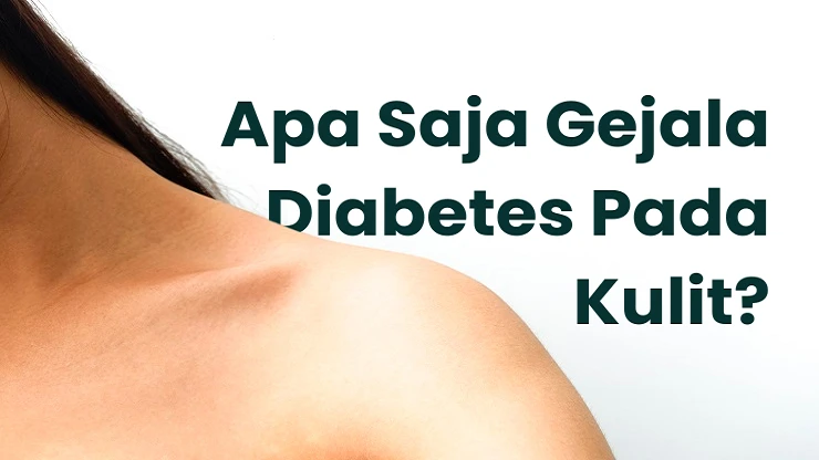 Gejala Diabetes Pada Kulit dan Cara Mengatasinya