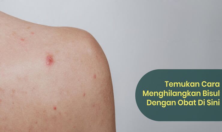 Cara Mengatasi Bisul Dengan Cepat Obat Salep Dan Panduannya