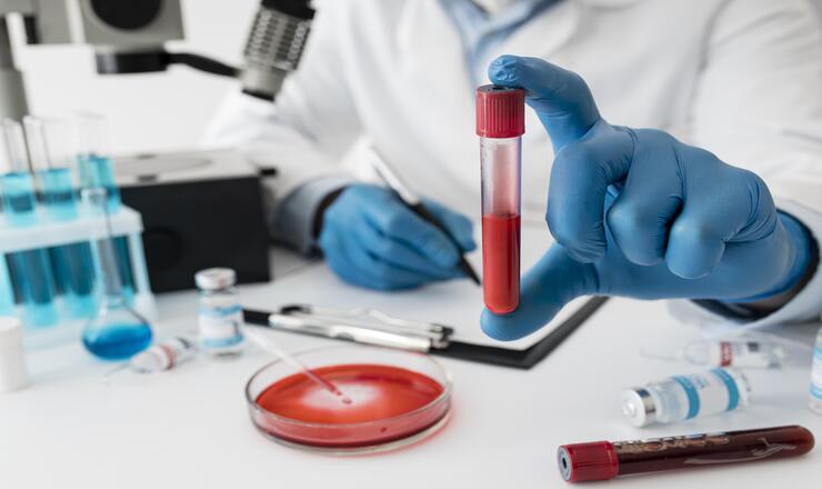 Cek Hemoglobin: Ketahui Fungsi, Prosedur, dan Biaya Pemeriksaannya