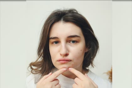 a women face on acne causing cosmetic ingredients/health/punjabmode