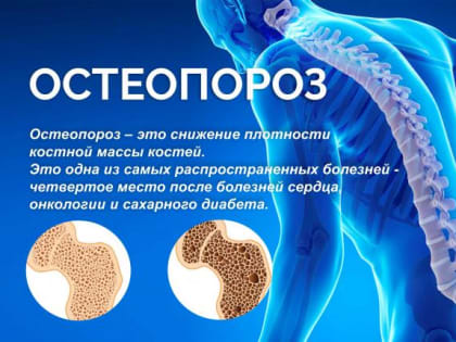 Медицина в ГБУЗ РКБ им. Г. Г. Куватова: Остеопороз