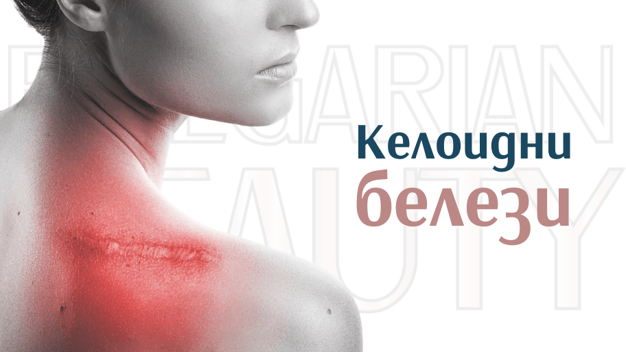 Симпроми на Келоидни белези