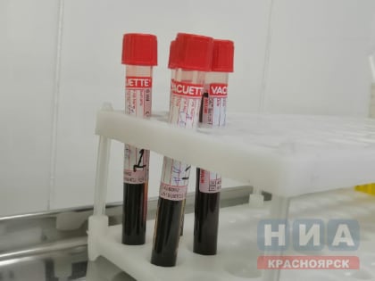 Краевой Центр СПИД проводит экспресс-тестирование на избирательных участках